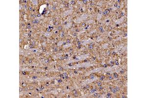 IHC analysis of Gephyrin/GPHN using anti-Gephyrin/GPHN antibody (ABIN7600086). (Gephyrin Antikörper  (AA 148-736))