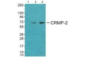 Western blot analysis of extracts from HuvEc cells (Lane 2) and JK cells (Lane 3), using CRMP-2 (Ab-522) antiobdy.
