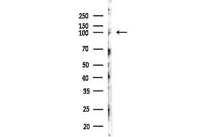 Western blot analysis of lysates from LoVo cells(heat-shock,45 min treatment), using EZH2 Antibody at 1/1000 dilution.