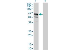 Western Blot analysis of NT5C2 expression in transfected 293T cell line by NT5C2 monoclonal antibody (M02), clone 3C1. (NT5C2 Antikörper  (AA 1-561))