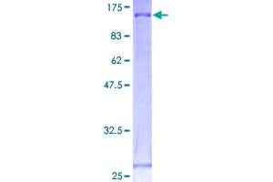 Image no. 1 for Cadherin 18, Type 2 (CDH18) (AA 1-790) protein (GST tag) (ABIN1348897) (CDH18 Protein (AA 1-790) (GST tag))