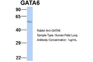 Host:  Rabbit  Target Name:  GATA6  Sample Type:  Human Fetal Lung  Antibody Dilution:  1.