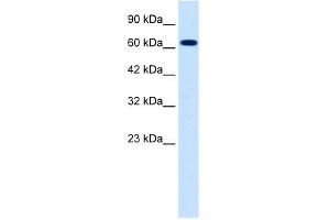 Western Blotting (WB) image for anti-Sodium Channel, Nonvoltage-Gated 1, beta (SCNN1B) (C-Term) antibody (ABIN2776090)