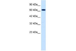 WB Suggested Anti-SCNN1B Antibody Titration:  0. (SCNN1B Antikörper  (C-Term))