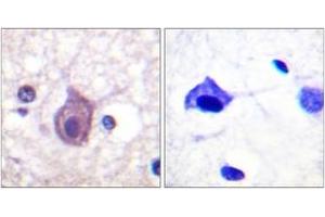 Immunohistochemistry analysis of paraffin-embedded human brain, using CD4 (Phospho-Ser433) Antibody. (CD4 Antikörper  (pSer433))