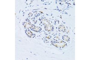Immunohistochemistry of paraffin-embedded human breast using CDKN1A antibody (ABIN4903234) at dilution of 1:100 (40x lens). (p21 Antikörper)