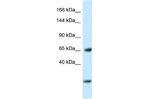 WB Suggested Anti-Ebf3 Antibody   Titration: 1.