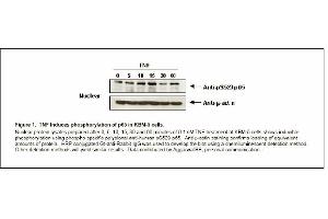 Image no. 1 for anti-Nuclear Factor-kB p65 (NFkBP65) (pSer529) antibody (ABIN116929) (NF-kB p65 Antikörper  (pSer529))