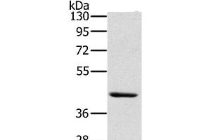 Western Blot analysis of Skov3 cell using HSD3B7 Polyclonal Antibody at dilution of 1:400