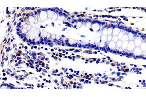 Detection of IL2Ra in Porcine Colon Tissue using Polyclonal Antibody to Interleukin 2 Receptor Alpha (IL2Ra) (CD25 Antikörper  (AA 22-245))