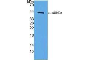 Detection of Recombinant MRP1, Human using Polyclonal Antibody to Motility Related Protein (MRP1) (CD9 Antikörper  (AA 112-195))