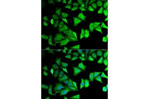 Immunofluorescence analysis of MCF-7 cells using RPS12 antibody (ABIN5973491). (RPS12 Antikörper)
