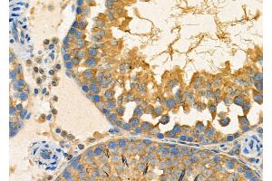 ABIN6263383 and ABIN6267002 at 1/100 staining Rat testis tissue by IHC-P. (MRRF Antikörper  (Internal Region))