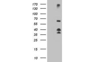 Western Blotting (WB) image for anti-Dystrobrevin, beta (DTNB) antibody (ABIN1497917) (Dystrobrevin beta Antikörper)