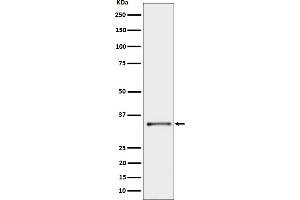 Western blot analysis of CYB5R3 expression in A431 cell lysate.