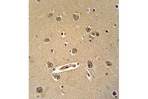 Formalin fixed, paraffin embedded human brain tissue stained with MGC24039 Antibody (C-term)  followed by peroxidase conjugation of the secondary antibody and DAB staining. (MGC24039 (AA 1073-1102), (C-Term) Antikörper)