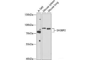 Western blot analysis of extracts of various cell lines using SH3BP2 Polyclonal Antibody at dilution of 1:1000. (SH3BP2 Antikörper)