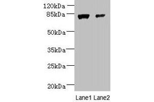 Western blot All lanes: WDR49 antibody at 7 μg/mL Lane 1: A549 whole cell lysate Lane 2: Hela whole cell lysate Secondary Goat polyclonal to rabbit IgG at 1/10000 dilution Predicted band size: 80, 60 kDa Observed band size: 80 kDa (WDR49 Antikörper  (AA 251-500))
