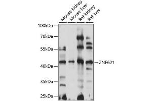 Western blot analysis of extracts of various cell lines, using ZNF621 antibody  at 1:1000 dilution. (ZNF621 Antikörper  (AA 60-150))