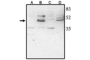 Image no. 1 for anti-Visual System Homeobox 2 (VSX2) (AA 264-361), (C-Term) antibody (ABIN265010) (VSX2 Antikörper  (C-Term))