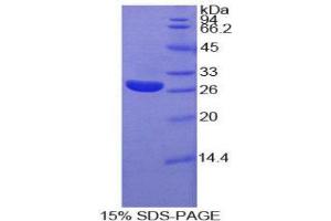 SDS-PAGE (SDS) image for Cysteine-Rich, Angiogenic Inducer, 61 (CYR61) (AA 178-381) protein (His tag) (ABIN1880077)