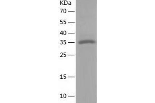 RCN3 Protein (AA 21-328) (His tag)