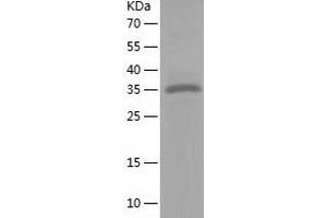 Western Blotting (WB) image for Reticulocalbin 3, EF-Hand Calcium Binding Domain (RCN3) (AA 21-328) protein (His tag) (ABIN7124835)