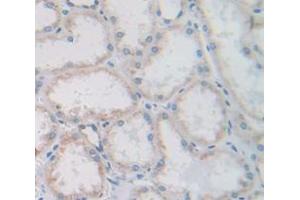 IHC-P analysis of Human Tissue, with DAB staining. (CUBN Antikörper  (AA 3157-3274))