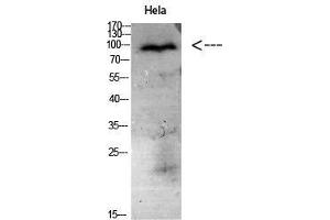 Western Blot (WB) analysis of HeLa cells using Antibody diluted at 1:1000. (CD56 Antikörper)