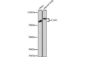 Western blot analysis of extracts of various cell lines, using Coilin Rabbit mAb (ABIN7266451) at 1:1000 dilution. (Coilin Antikörper)