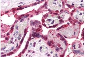 Immunohistochemistry (IHC) image for anti-Solute Carrier Family 29 (Nucleoside Transporters), Member 1 (SLC29A1) (Internal Region) antibody (ABIN1048565)