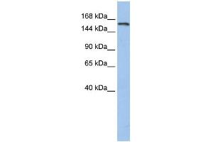 WB Suggested Anti-UBE3A  Antibody Titration: 0.