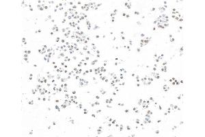 Immunocytochemistry (ICC) image for anti-Zinc Finger CCCH-Type Containing 4 (ZC3H4) (AA 1050-1100) antibody (ABIN7795760)