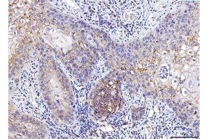 IHC analysis of Poliovirus Receptor/PVR using anti-Poliovirus Receptor/PVR antibody (ABIN7601071). (Poliovirus Receptor Antikörper  (AA 28-331))