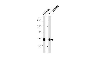 All lanes : Anti-FLT1 Antibody at 1:2000 dilution Lane 1: human Liver lysates Lane 2: human placenta lysates Lysates/proteins at 20 μg per lane. (FLT1 Antikörper  (AA 1-380))