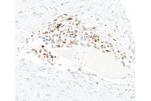 Immunohistochemistry (IHC) image for anti-Interferon Regulatory Factor 1 (IRF1) (AA 250-300) antibody (ABIN7454011)