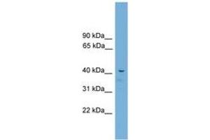 Image no. 1 for anti-Adrenocortical Dysplasia Homolog (ACD) (C-Term) antibody (ABIN6744514) (ACD Antikörper  (C-Term))
