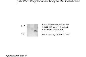 Image no. 1 for anti-Vesicle-Associated Membrane Protein 3 (VAMP3) (N-Term) antibody (ABIN347007) (VAMP3 Antikörper  (N-Term))