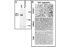 A) Rat B50 brain tumor cell extracts were immunoprecipitated with RIZ1 antibody (cat (ABIN388010 and ABIN2845353)) or preimmune (ref. (PRDM2 Antikörper  (AA 245-573))