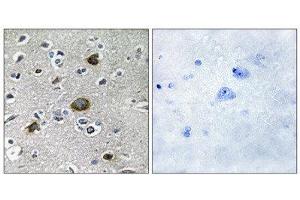 Immunohistochemistry (IHC) image for anti-A Kinase (PRKA) Anchor Protein 1 (AKAP1) (Internal Region) antibody (ABIN1849848) (AKAP1 Antikörper  (Internal Region))