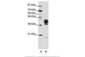 Image no. 2 for anti-Heterogeneous Nuclear Ribonucleoprotein D (HNRNPD) (C-Term) antibody (ABIN203266) (HNRNPD/AUF1 Antikörper  (C-Term))