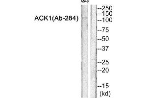 Western Blotting (WB) image for anti-tyrosine Kinase, Non-Receptor, 2 (TNK2) (Tyr284) antibody (ABIN1847978) (TNK2 Antikörper  (Tyr284))