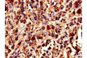 Immunohistochemistry (IHC) image for anti-X-Ray Repair Complementing Defective Repair in Chinese Hamster Cells 5 (Double-Strand-Break Rejoining) (XRCC5) (AA 251-455) antibody (ABIN7175897)