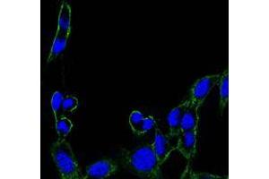 Immunofluorescence analysis of B16 cells using FAK mouse mAb (green). (FAK Antikörper)