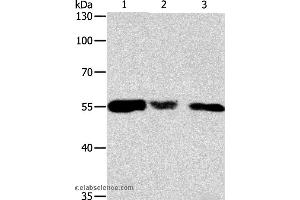 Western blot analysis of Hela, 293T and NIH/3T3 cell, using CALR Polyclonal Antibody at dilution of 1:500 (Calreticulin Antikörper)