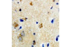 Immunohistochemical analysis of Biotinidase staining in rat brain formalin fixed paraffin embedded tissue section. (BTD Antikörper)