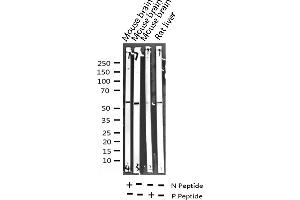 Western blot analysis of Phospho-GABA-RB (Ser434) expression in various lysates (GABA-RB (pSer434) Antikörper)