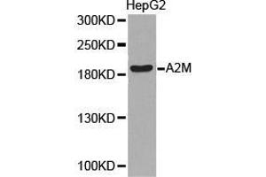 Western Blotting (WB) image for anti-alpha-2-Macroglobulin (A2M) antibody (ABIN1870709)