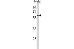 Western blot analysis of CYP7B1 Antibody (Center) in Hela cell line lysates (35ug/lane). (CYP7B1 Antikörper  (Middle Region))