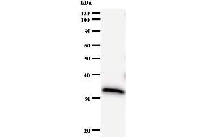 Western Blotting (WB) image for anti-DNA (Cytosine-5-)-Methyltransferase 3 beta (DNMT3B) antibody (ABIN933161) (DNMT3B Antikörper)